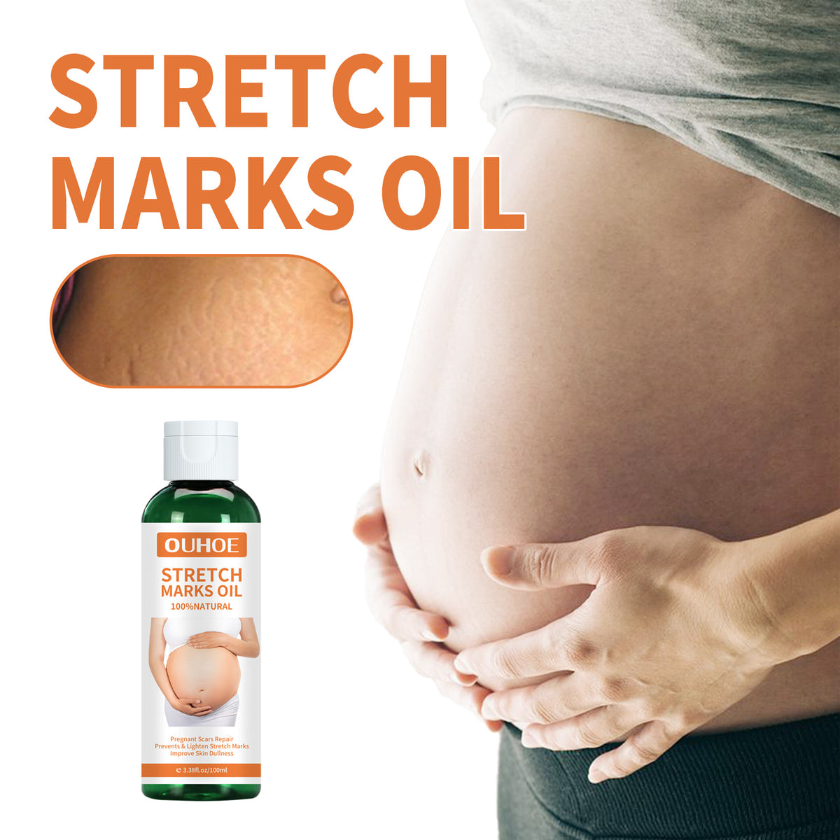 Nourishing Pregnancy Massage Oil for Stretch Mark Repair