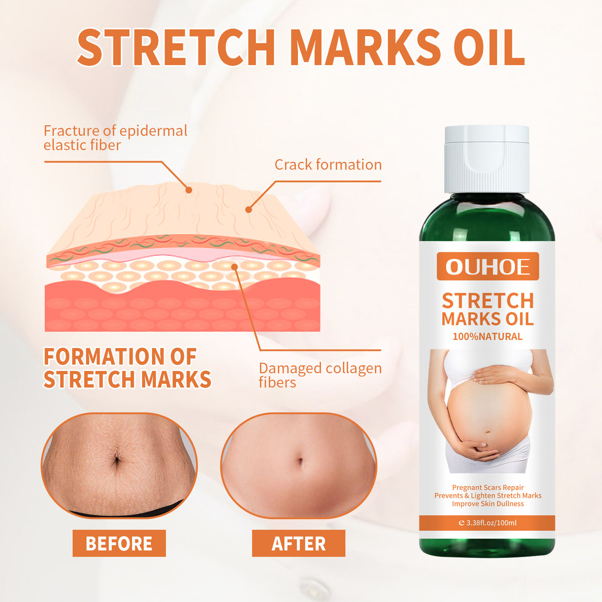 Nourishing Pregnancy Massage Oil for Stretch Mark Repair